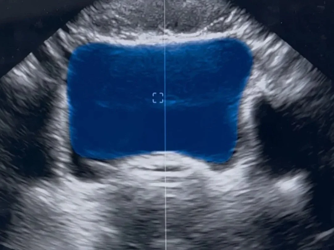 The Benefits of Using Ultrasound in Pelvic Floor Physical Therapy