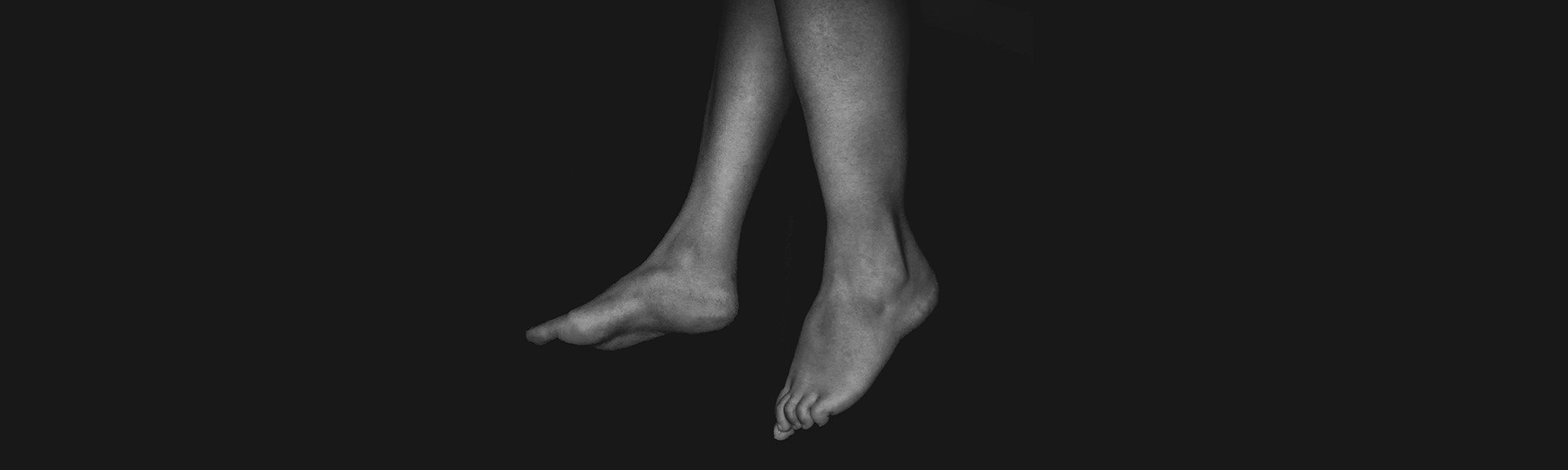 Lymphedema - What is this and how can I manage it?