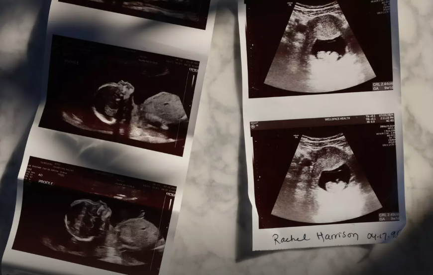 Pregnant in California ? What Catholic hospital rules can mean in emergency.