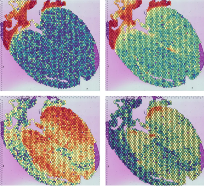 Beyond DNA: Why Multi-Omic and Spatial Data Are Essential for Precision Cardiovascular Medicine