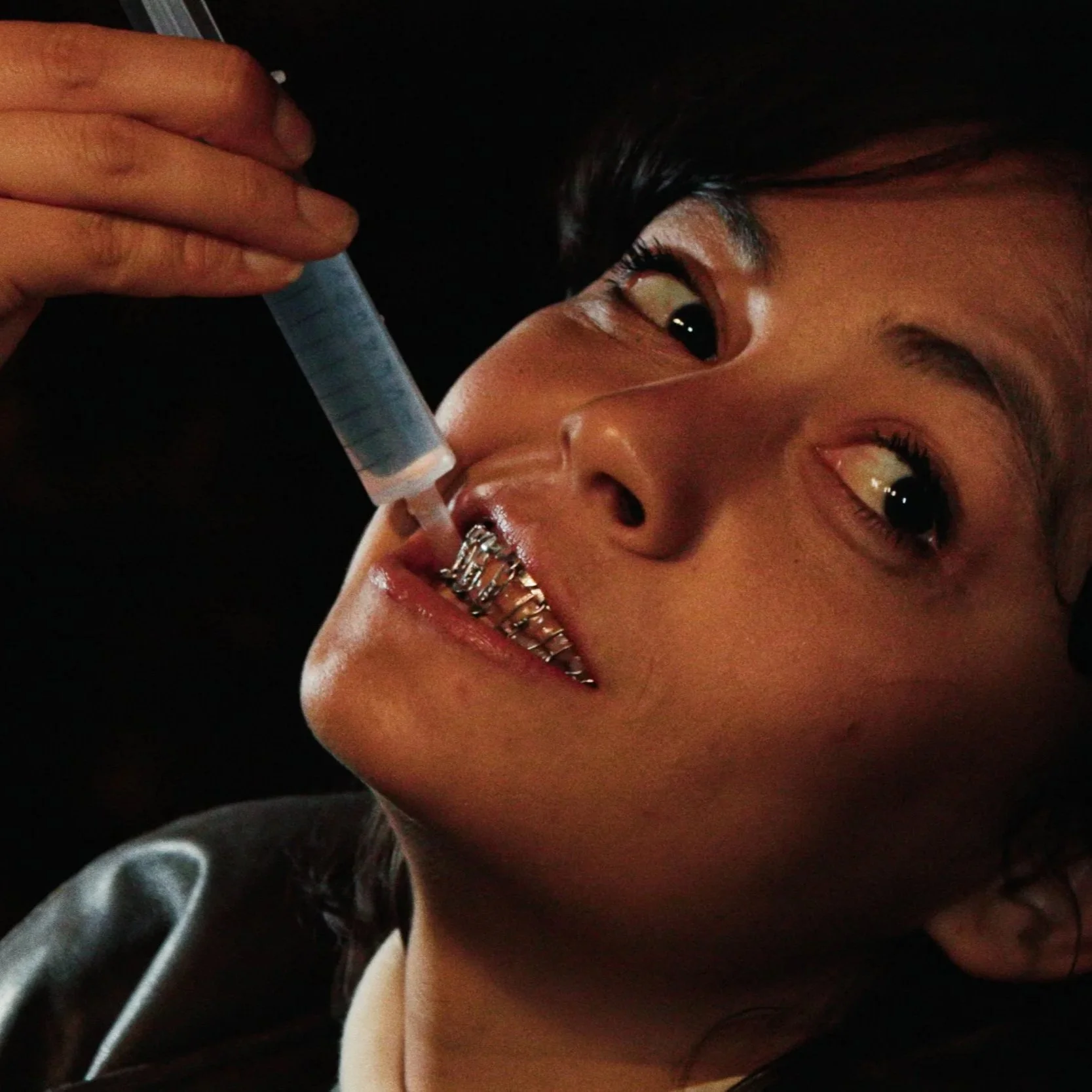 “Lockjaw” is a Wired Shut Anxiety Attack