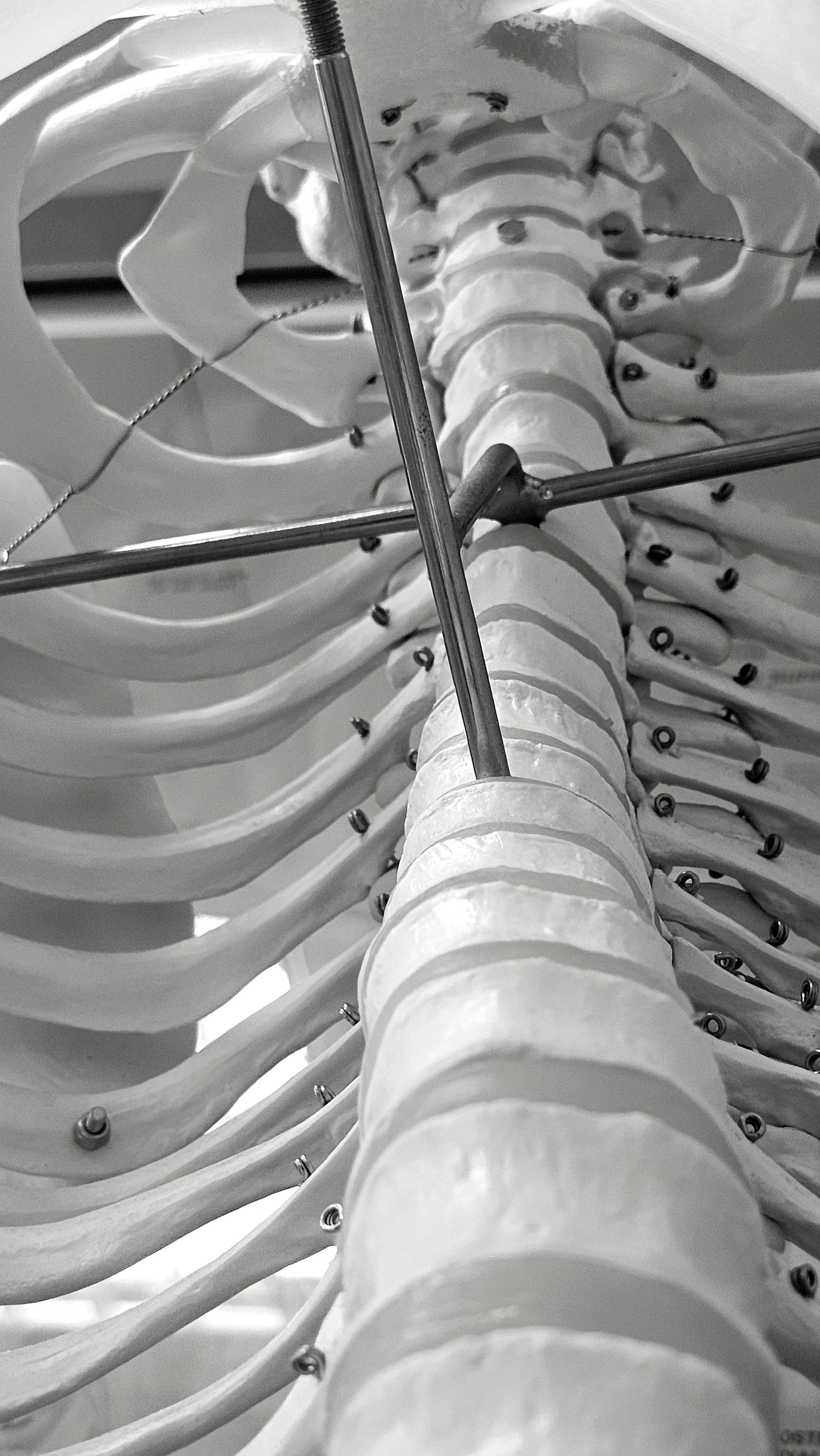 Understanding Spinal Injuries for International Spinal Cord Injury Day 2026.