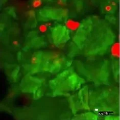 Microscopic image showing red and green fluorescent markers on biological tissue.
