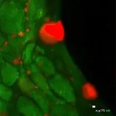Fluorescent microscopy image showing green cells with red fluorescent signals, possibly indicating cellular structures or markers.