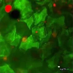 Microscopic green cells with red and black spots.