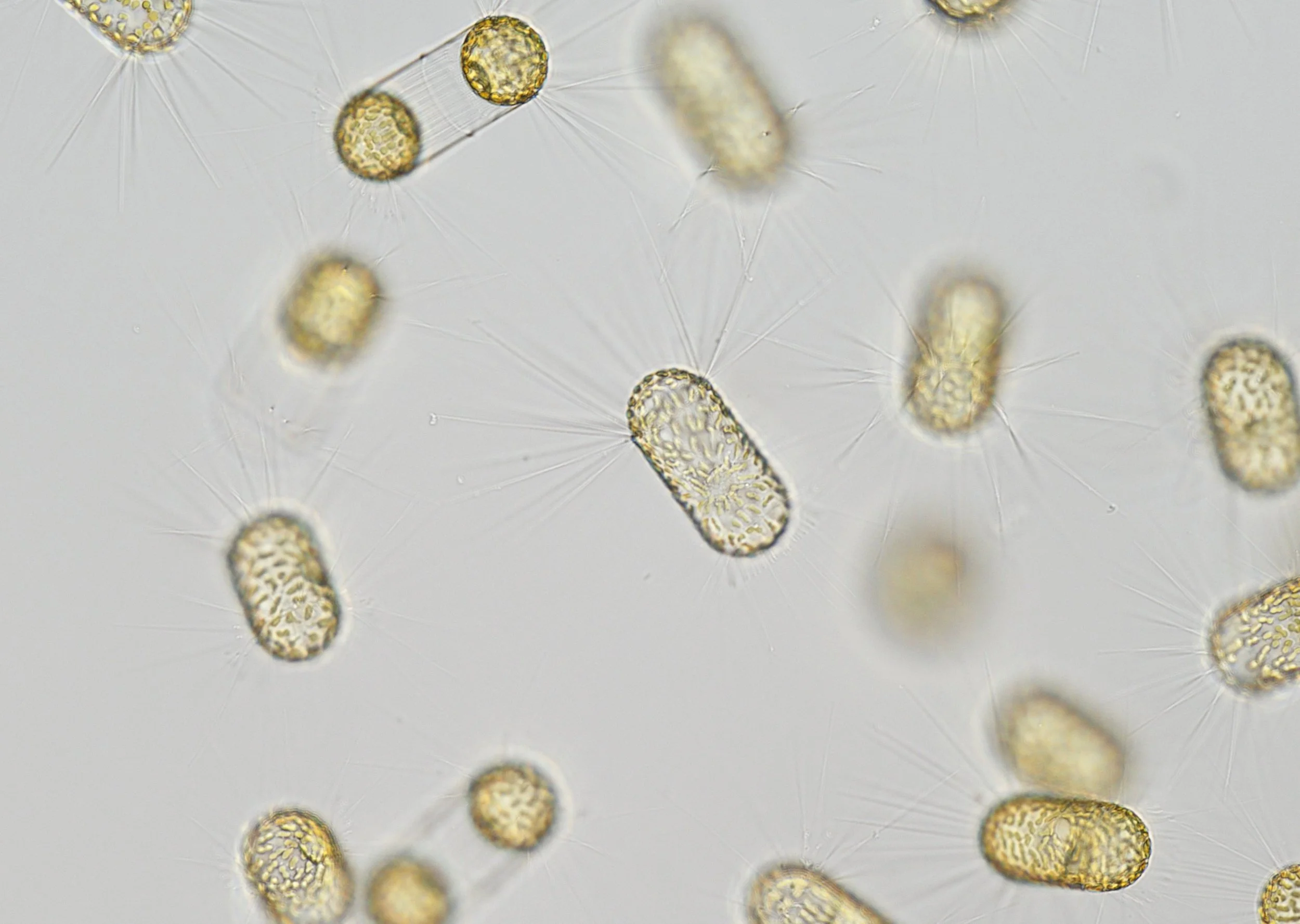 The centric diatom Corethron collected from the Galapagos, summer 2025