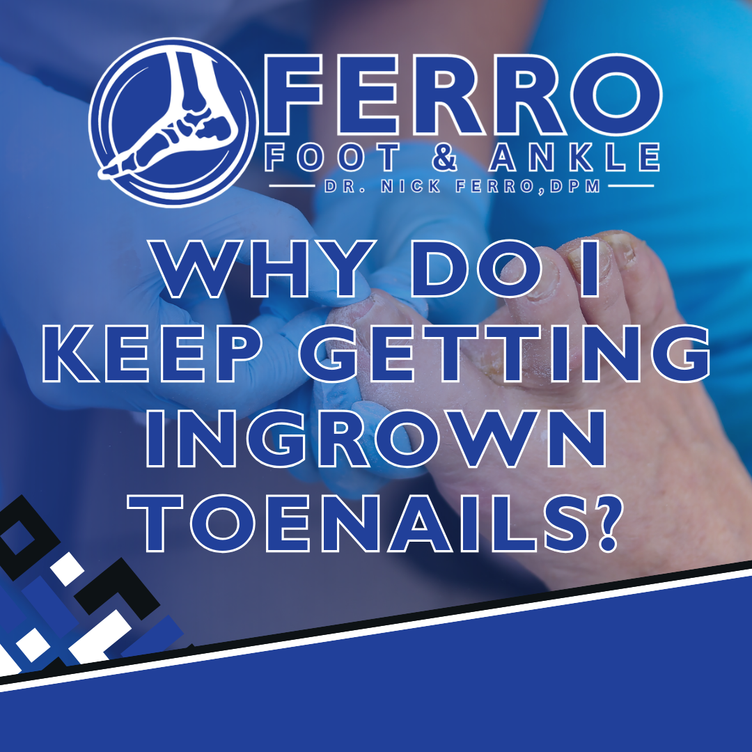 Why Do I Keep Getting Ingrown Toenails?