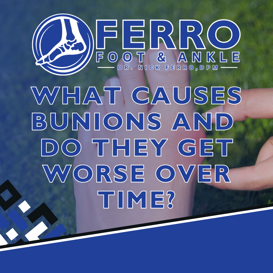 What Causes Bunions and Do They Get Worse Over Time?
