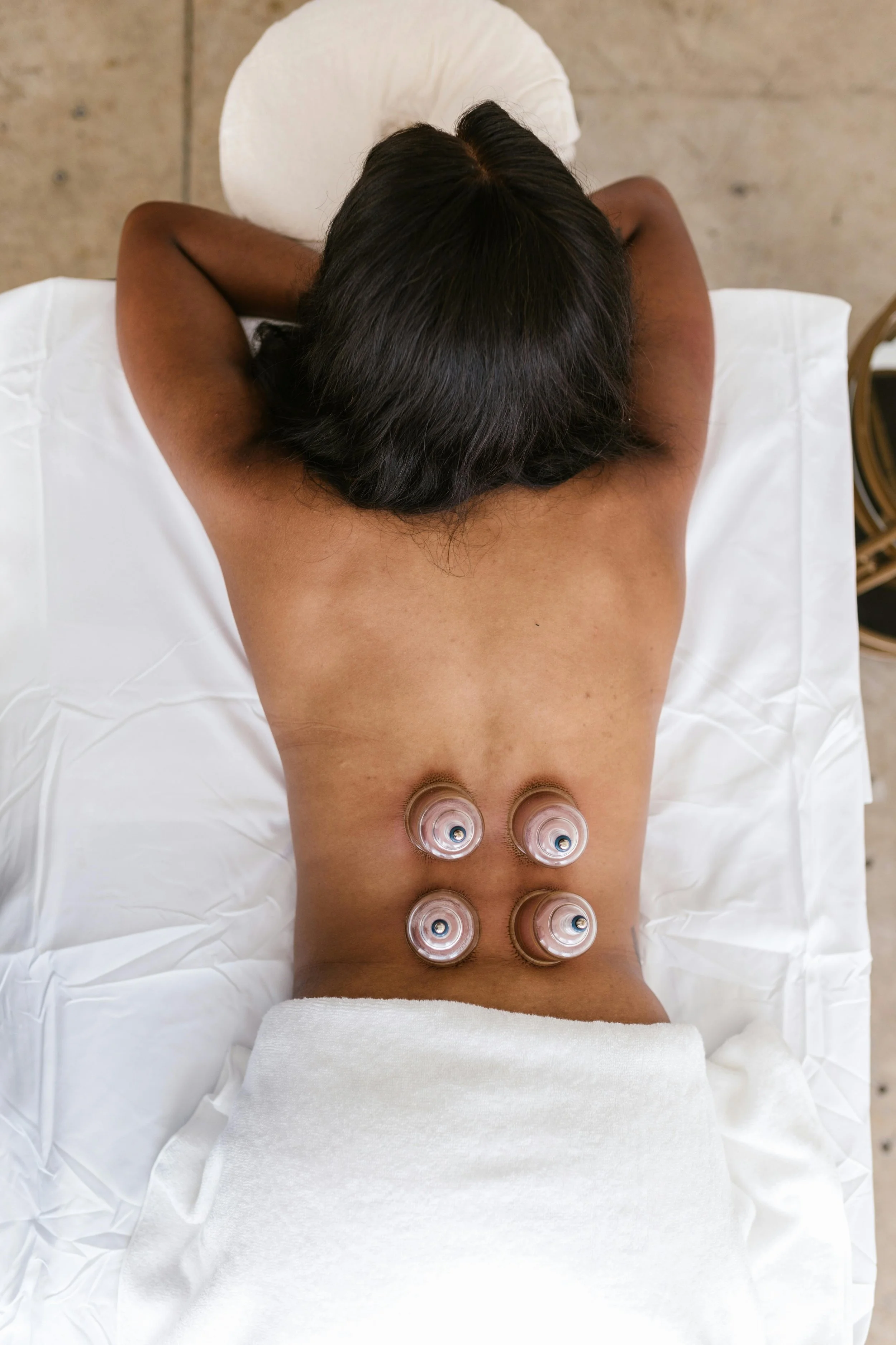 Cupping Therapy Explained: Benefits, Uses, and What to Expect