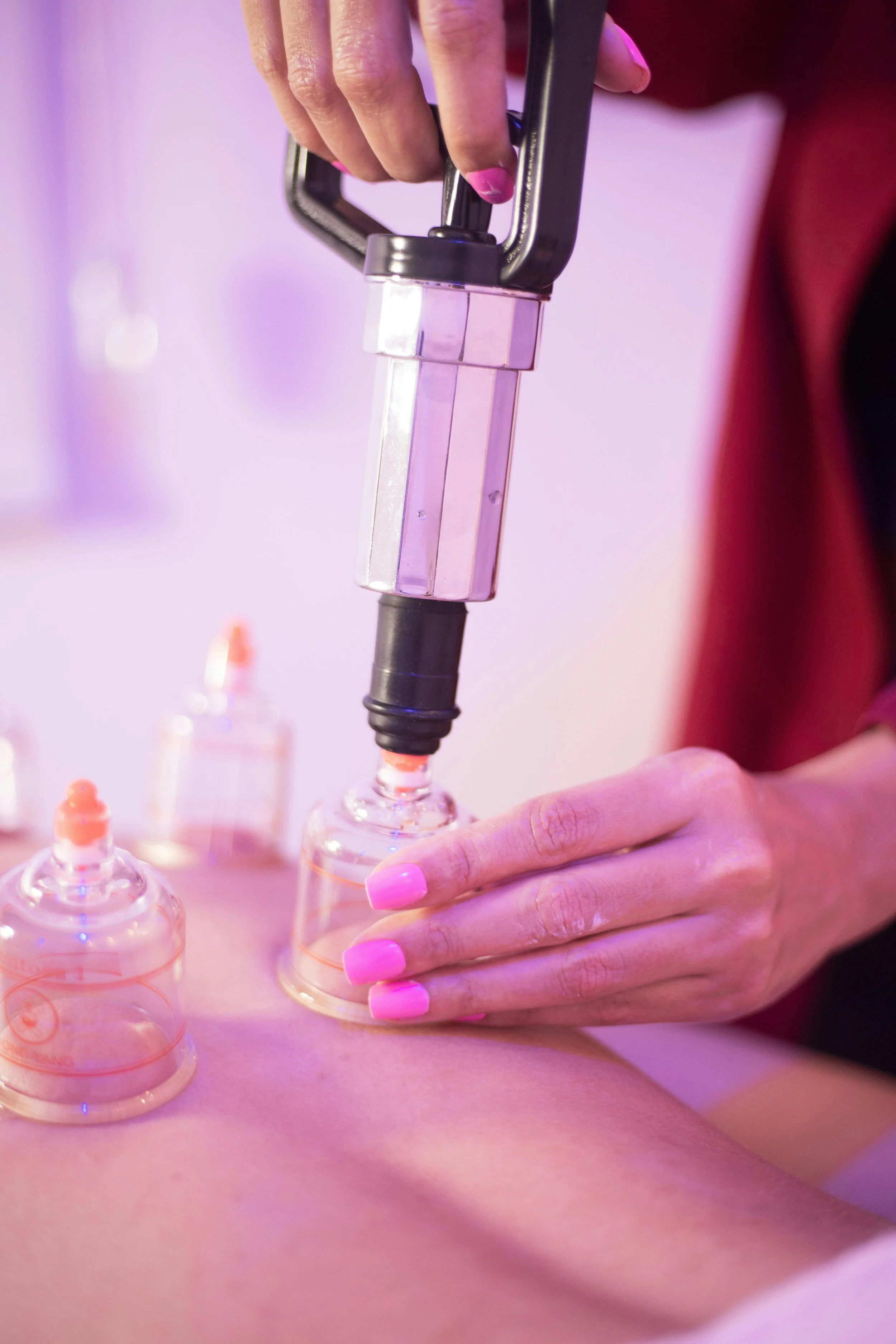 Cupping Therapy for Training Partners: Is It Effective?