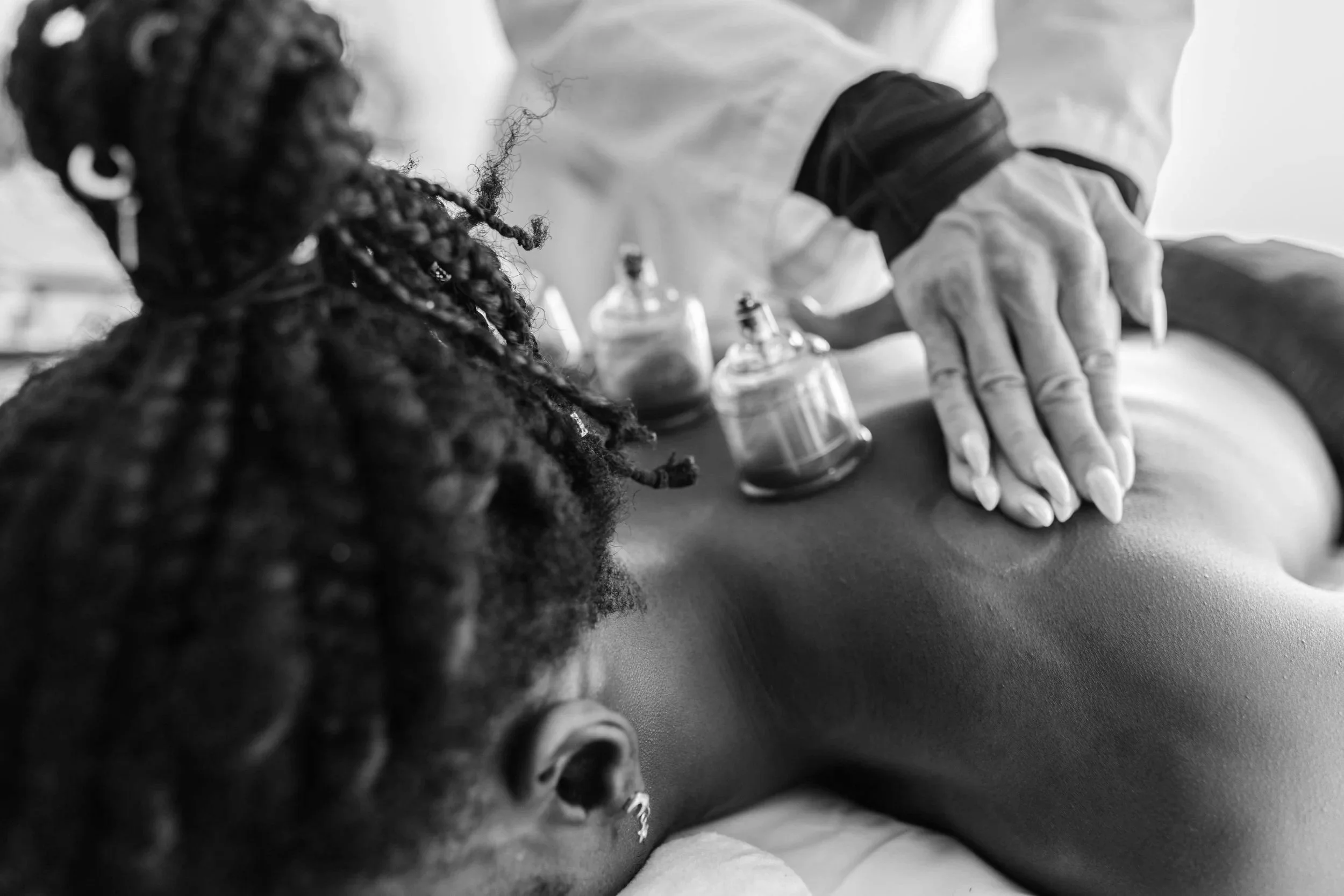 Cupping Therapy in London