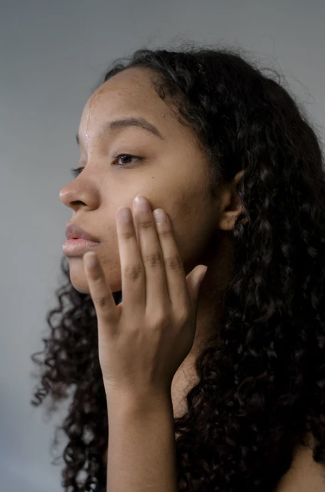 The Real Reason Adult Acne Keeps Coming Back: How to Decode the Patterns Behind Your Breakouts And Finally Treat Them Effectively