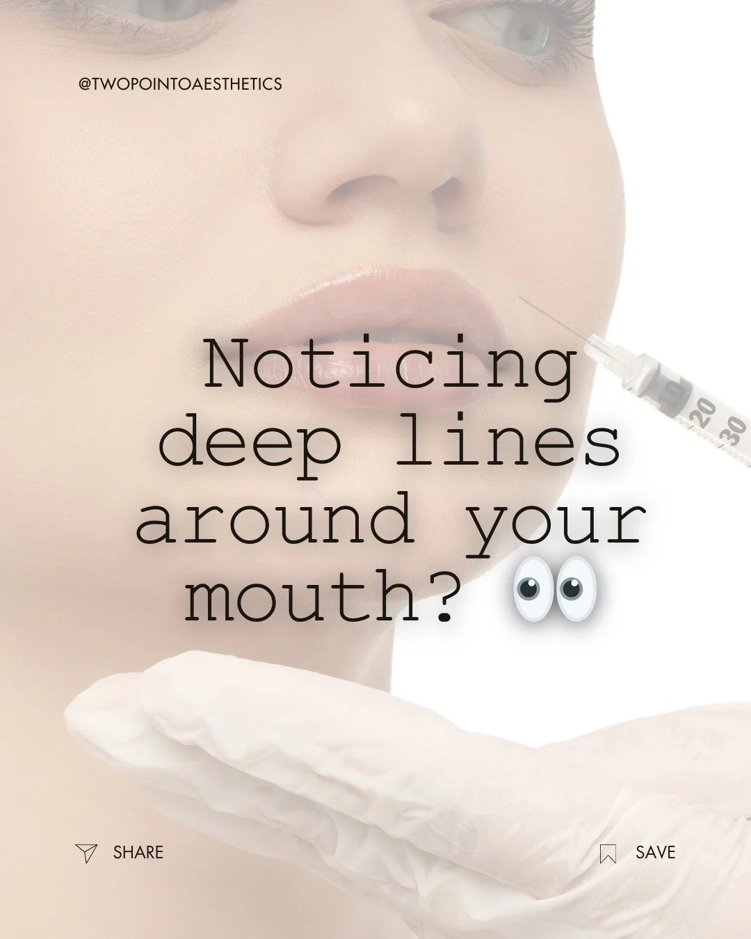 Marionette lines can make you look older or more tired than you feel&mdash;but the good news is, they&rsquo;re completely treatable. 💉✨ At 2.0 Aesthetics, we customize Botox and filler treatments to restore balance, smooth lines, and give you a more