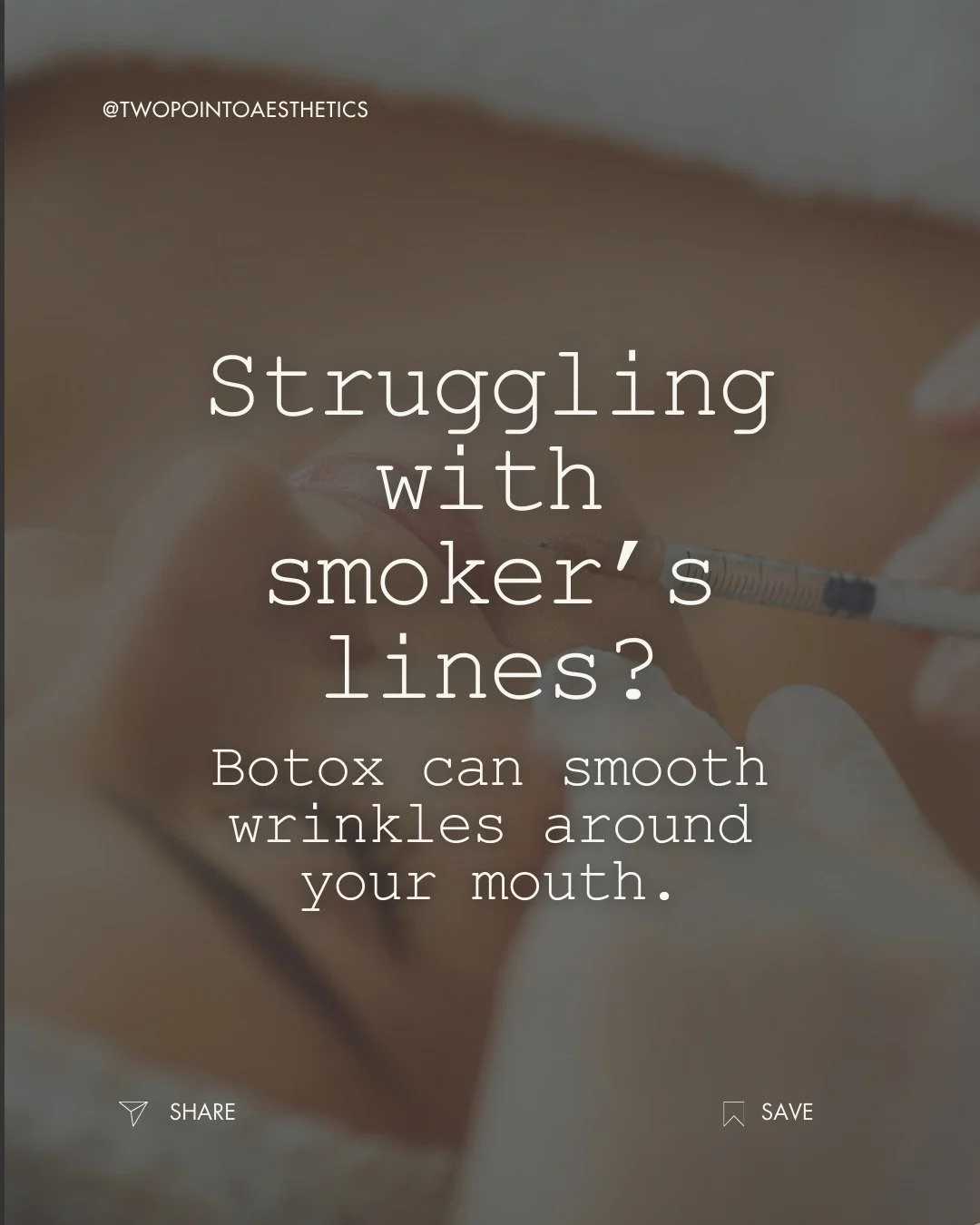 Smoker&rsquo;s lines (a.k.a. lipstick lines) can make you look older than you feel&mdash;but Botox offers a quick, non-invasive solution. 💉

✨ Smooth wrinkles above the lip
 ✨ Results in just a few days
 ✨ Natural, youthful appearance

Want to see i