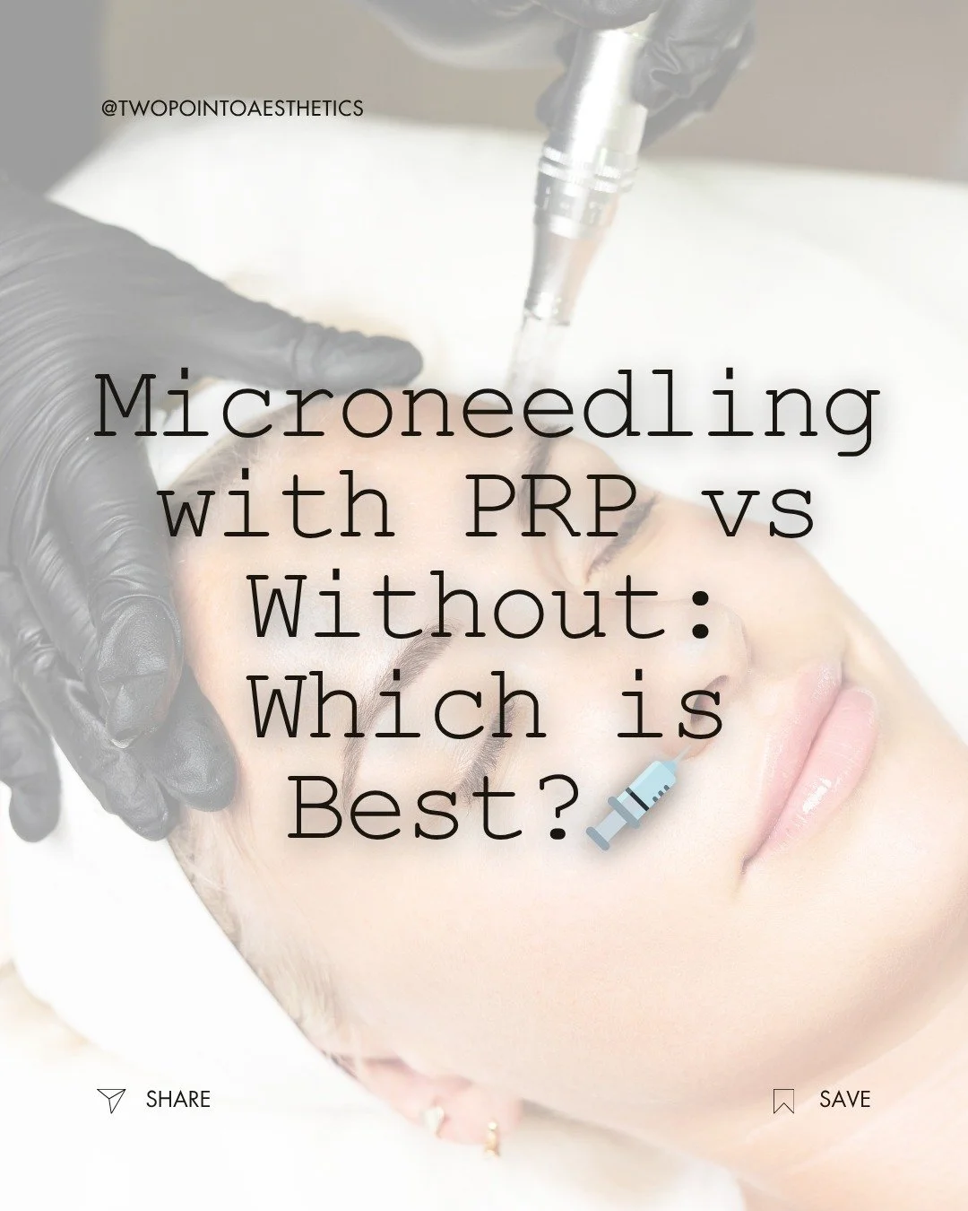 Thinking about microneedling but not sure if PRP is worth the extra step? 🤔

Microneedling boosts collagen for smoother, youthful skin. Adding PRP takes it further&mdash;faster recovery, longer glow, and hydration you&rsquo;ll notice.
💉 Microneedli