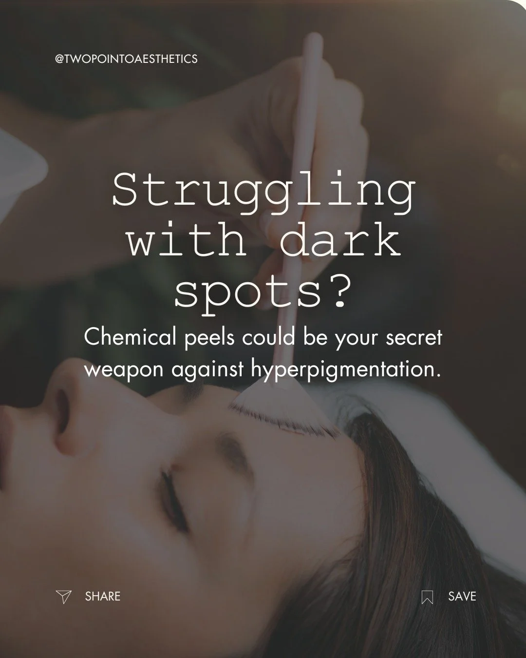 Dark spots don&rsquo;t have to be permanent. ✨ 

Chemical peels are one of the most effective hyperpigmentation treatments, helping fade dark patches and restore radiant skin. 

Curious which peel is right for you? 👉 Read our latest blog post on our