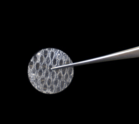 Amniodisc
