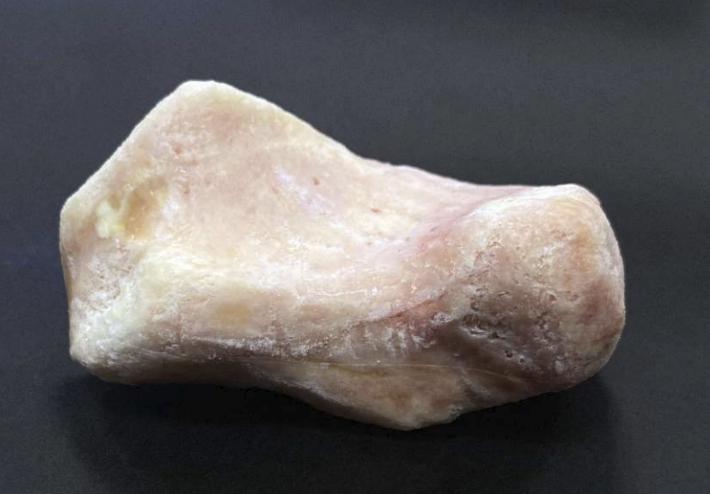 Calcaneus
