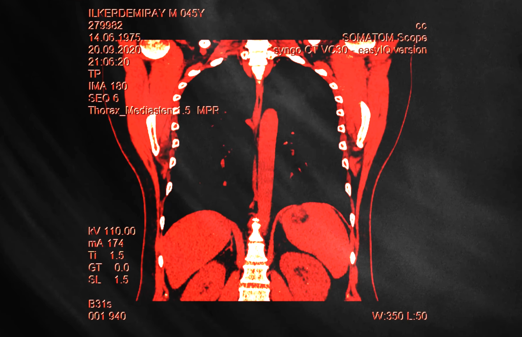 as an antidote to fear of death, i eat the stars