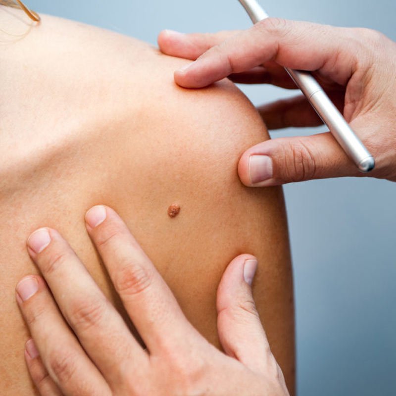 Surgical Dermatology