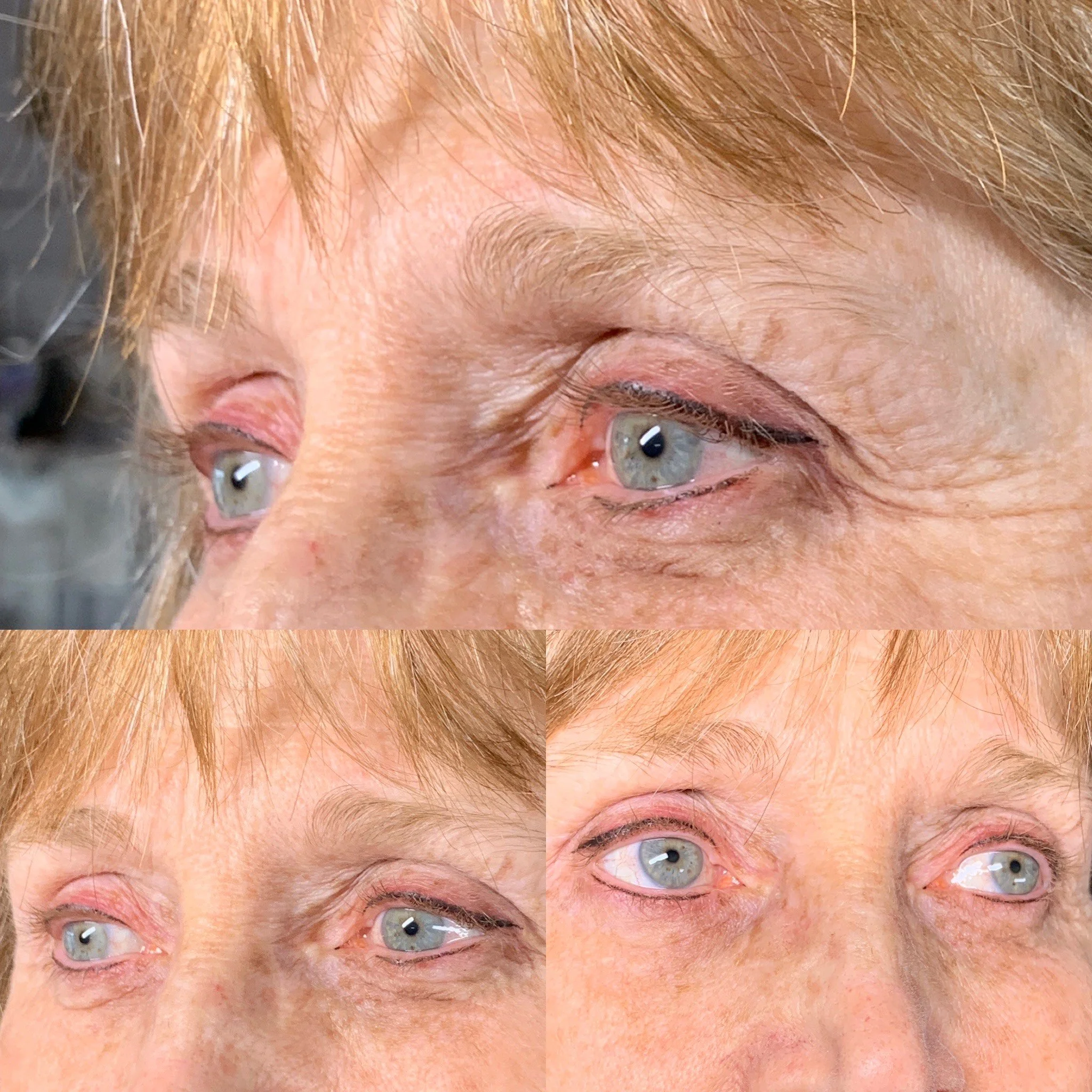 Cosmetic Tattooing Eyeliner