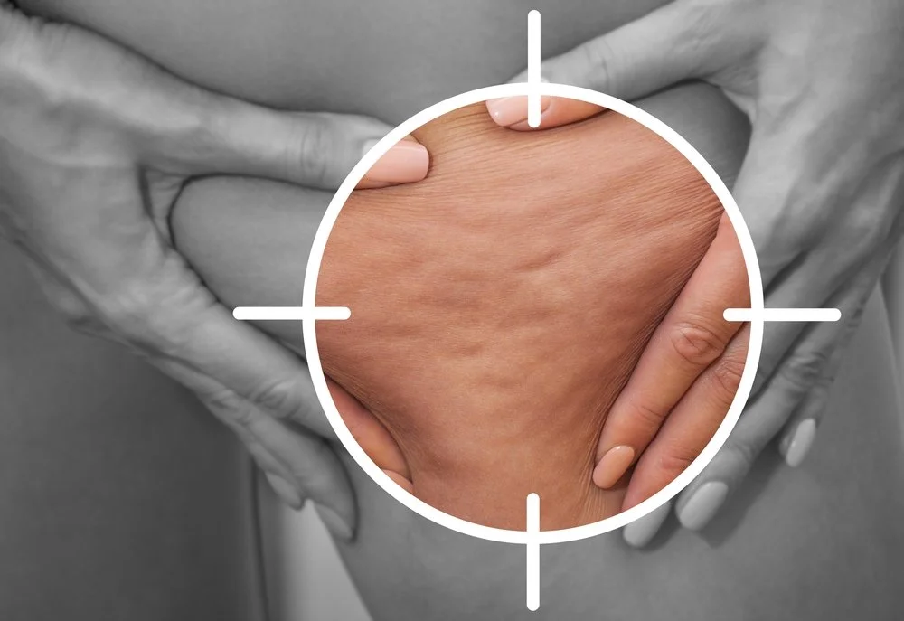 How Fibrosis Forms &amp; Why Lymphatic Massage Helps Soften It