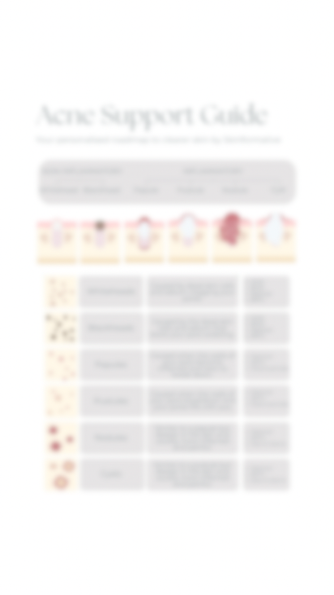 Acne Support Guide