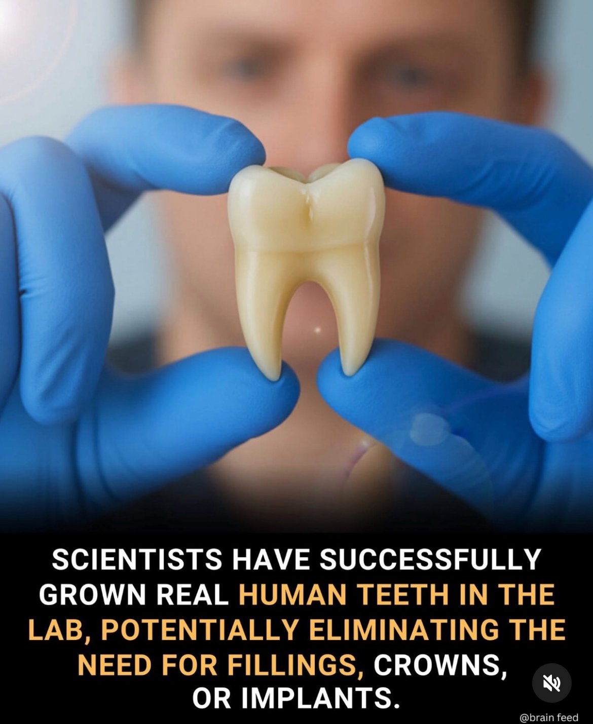From "Drill &amp; Fill to Regrow &amp; Heal": The Shift Toward Regenerative Dentistry.
