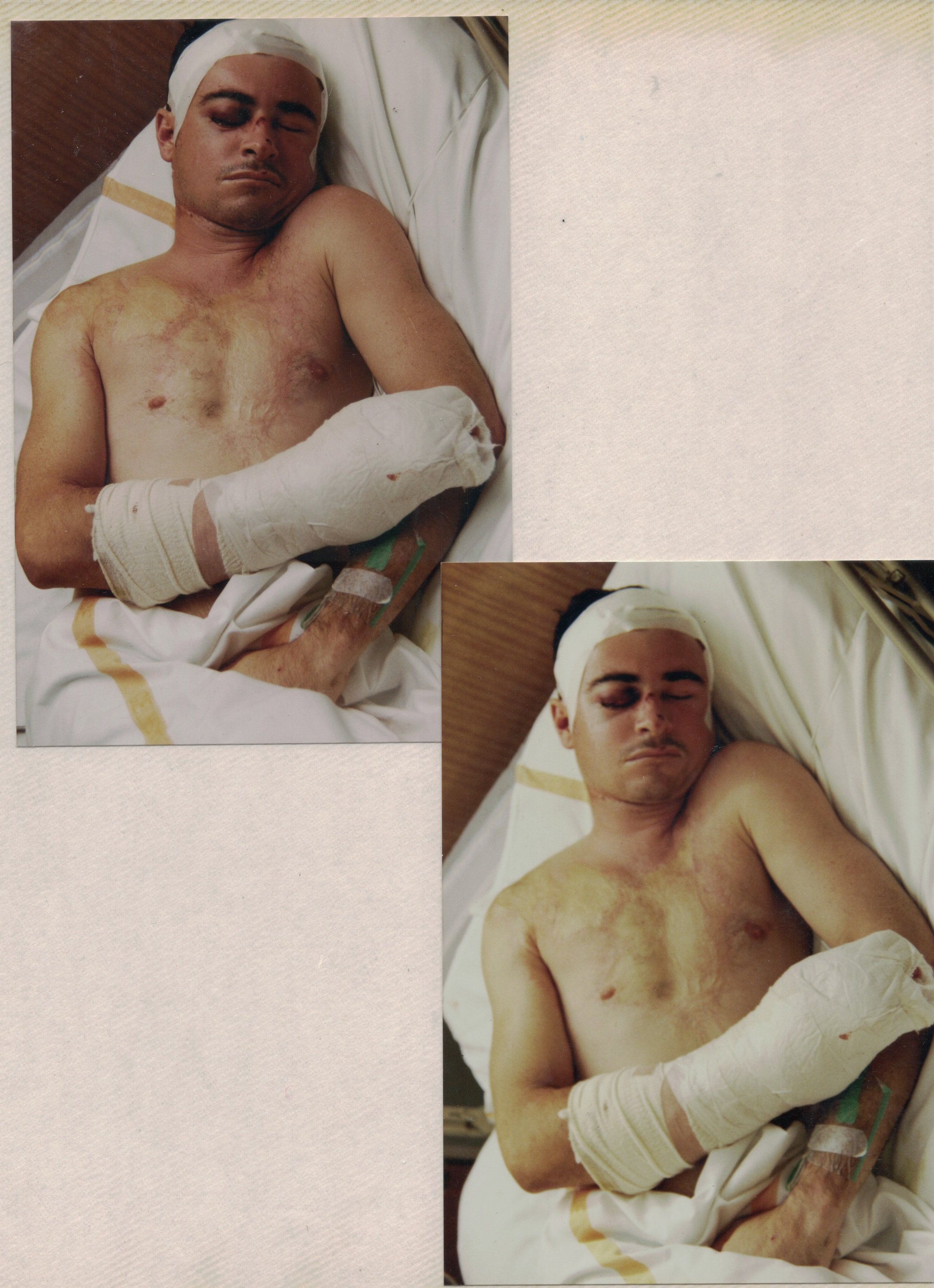 Tim in the hospital after being hit by a car as a pedestrian in 1992, while at the peak of his rowing career.