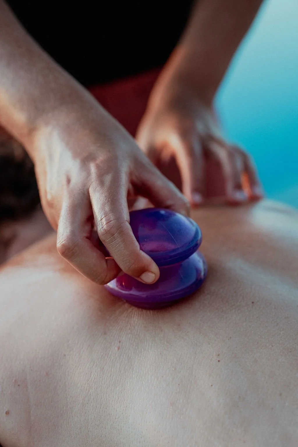 Silicone therapy cups placed cleanly on a client's back during a restorative mobile cupping session in the Cerritos Beach area.