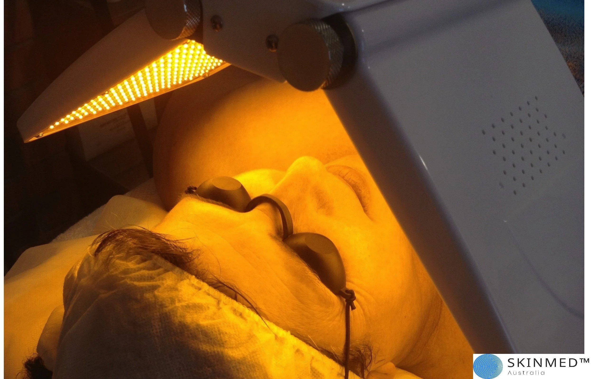 LED yellow light treatment