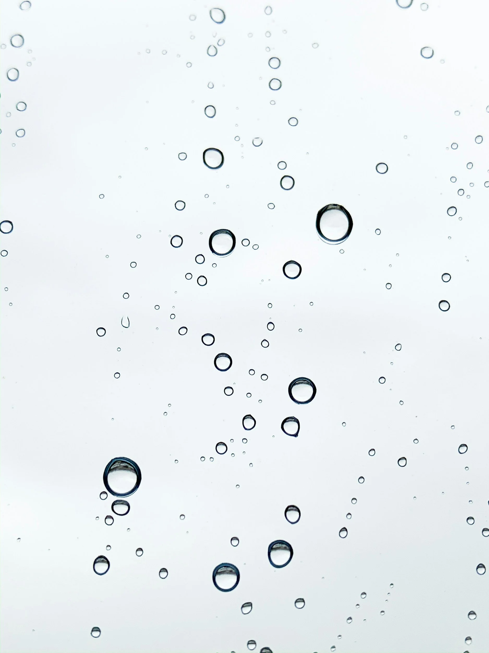 What Are Floaters—and When Should You Worry?