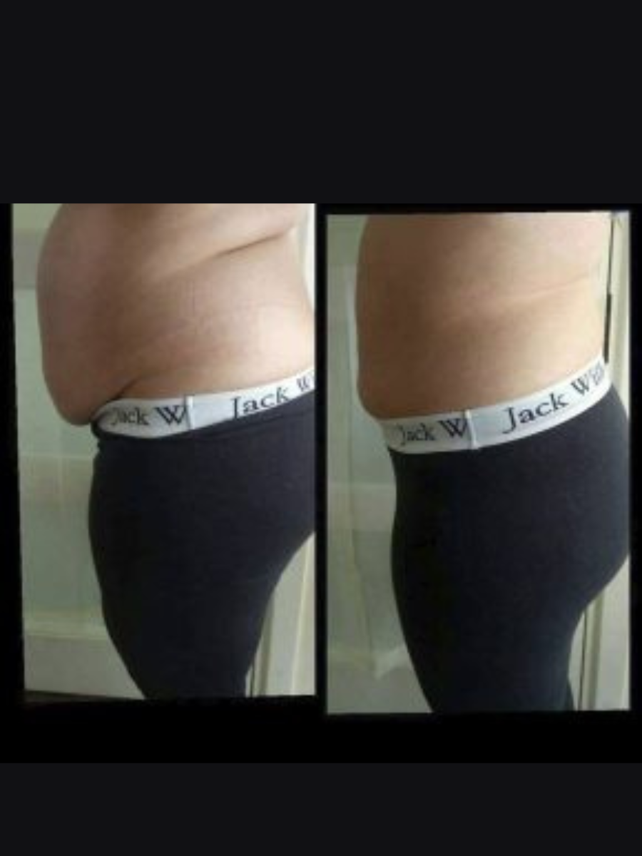 side tummy view.png