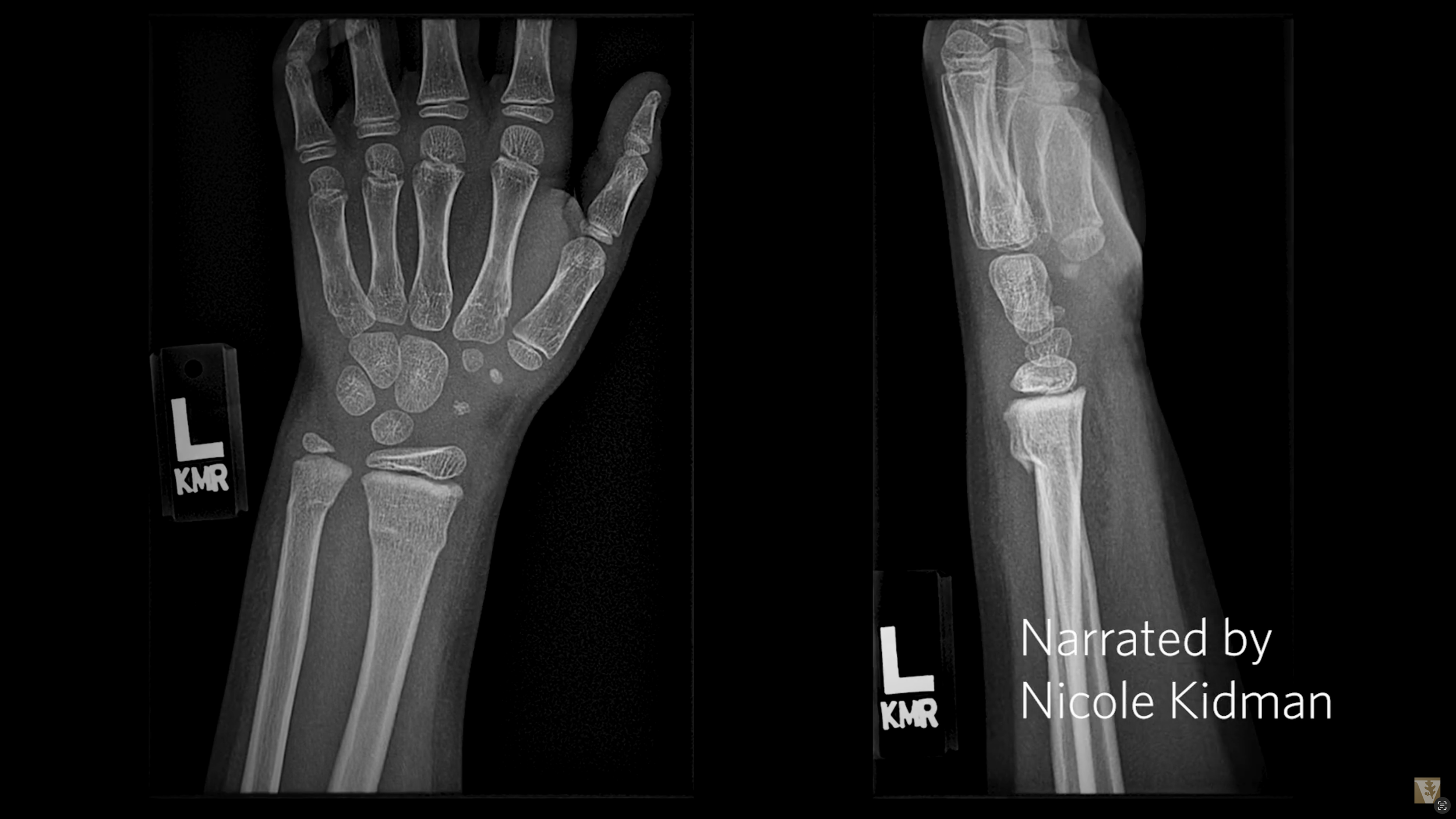 Vanderbilt University Medical Center - "From the Simple to the Complex" : Directed by Emil Kahr : Narrated by Nicole Kidman