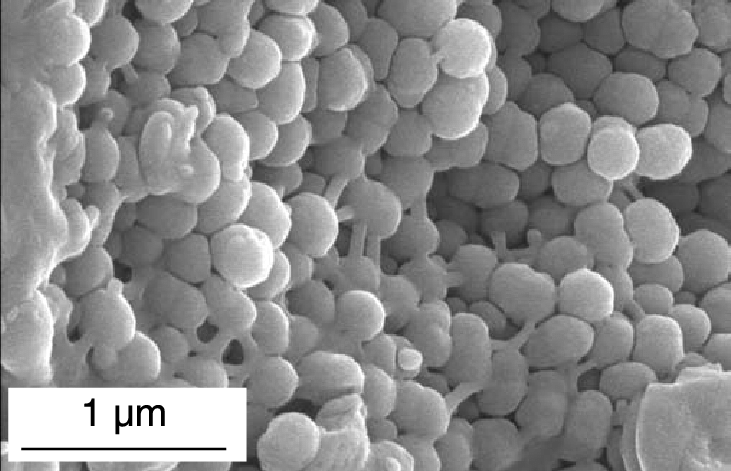 SEM of Common Opal