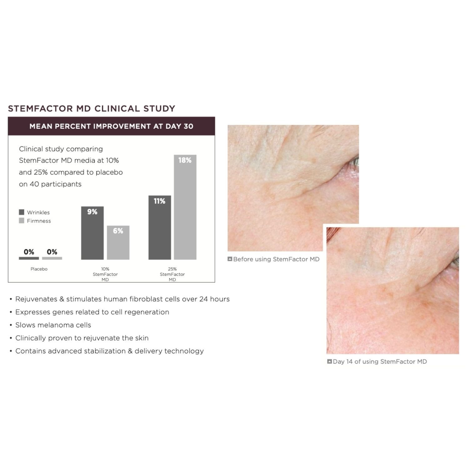 Osmosis-Stemfactor-clinical-study-graph+%282%29.jpg