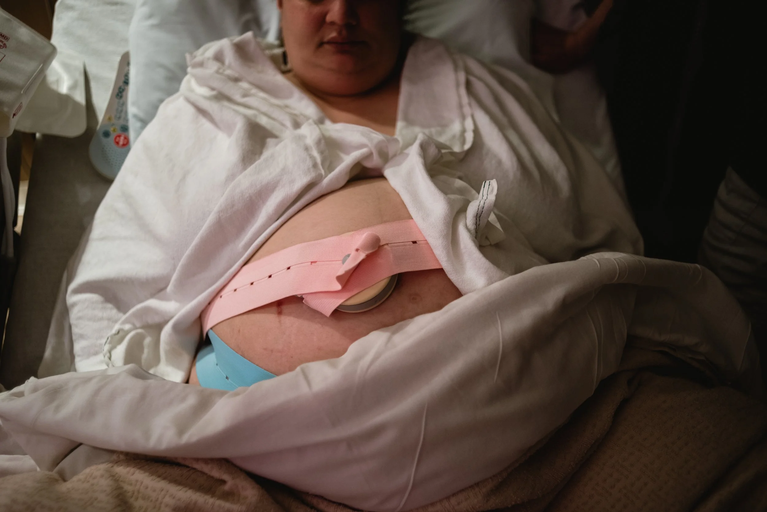  A close image of Beatrice in Lucy’s belly. The bottom half of Lucy’s face is shown, while the main focus is a pregnant belly wrapped in blankets. Two fetal monitor straps cross her belly, one light pink and the other light blue. Her belly is illumin