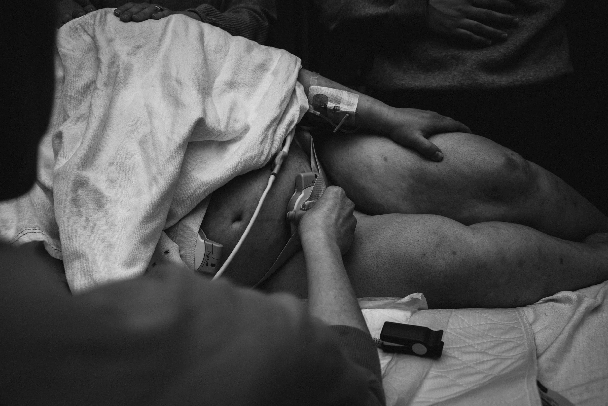  A black and white image of Lucy’s chest, belly, and legs as she lays on her side on a hospital bed. A large white blanket covers her chest, her belly just peeking out. Two fetal monitors are strapped to Lucy’s belly and a small plastic lead crosses 