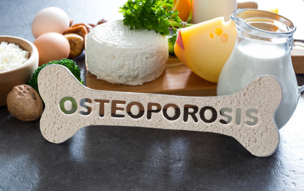 Osteoporosis: The Silent Disease