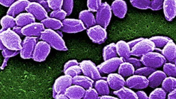 Haiti Anthrax Investigation Prompts Dominican Republic Cross-Border Surveillance Response