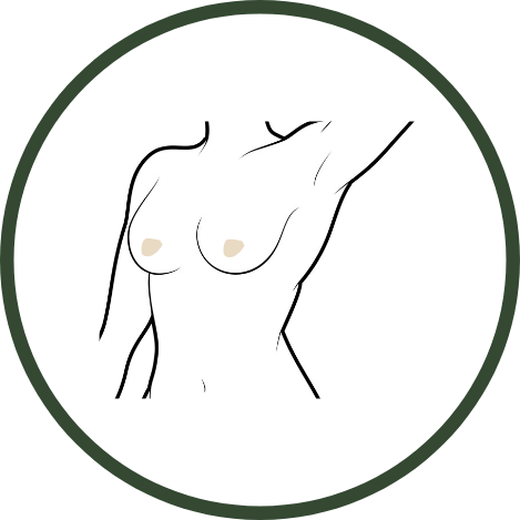 Areolas.png