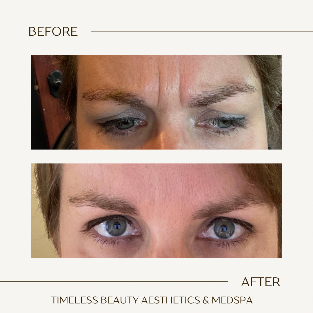Beige Brown Neutral Before + After Instagram Post.png