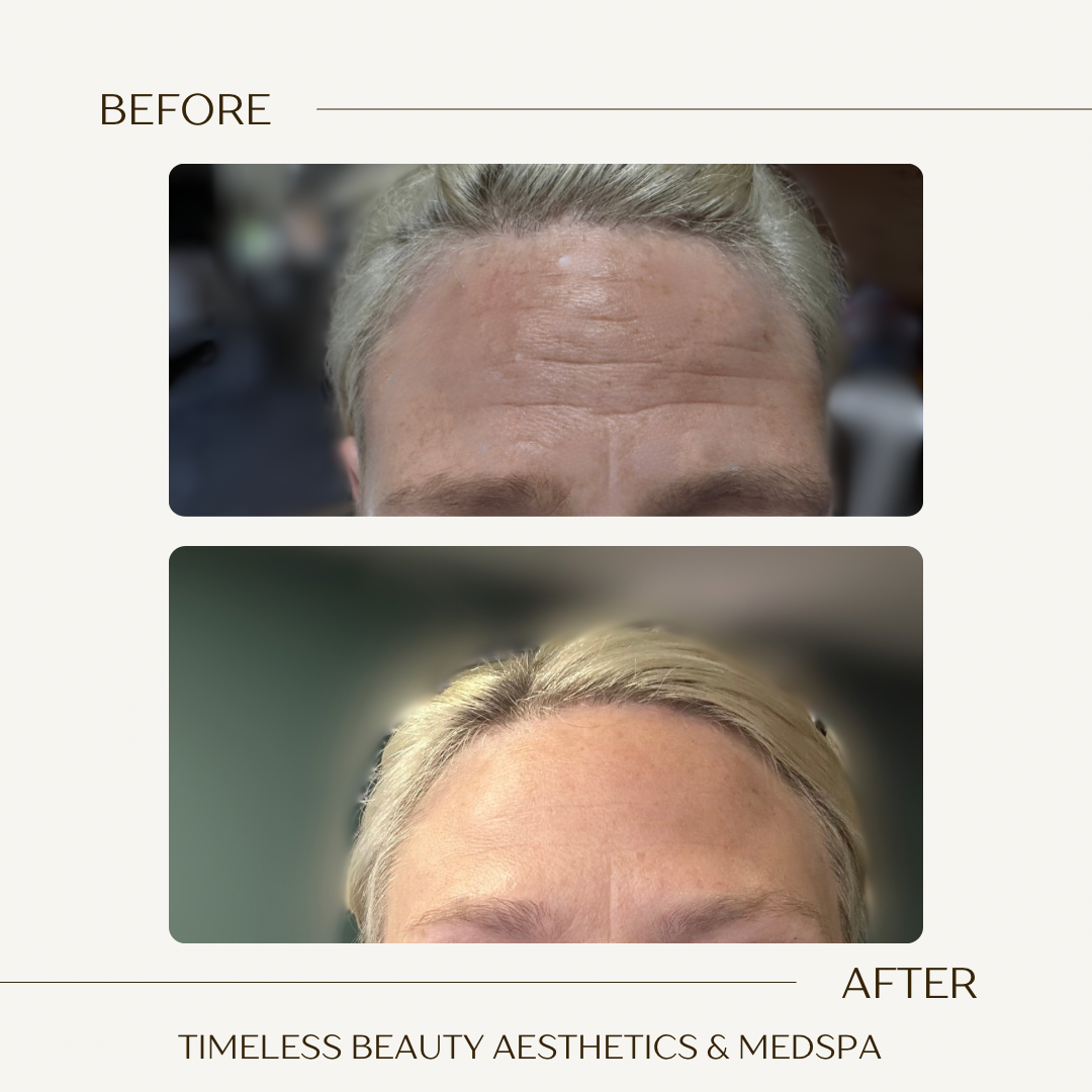 Beige Brown Neutral Before + After Instagram Post.png