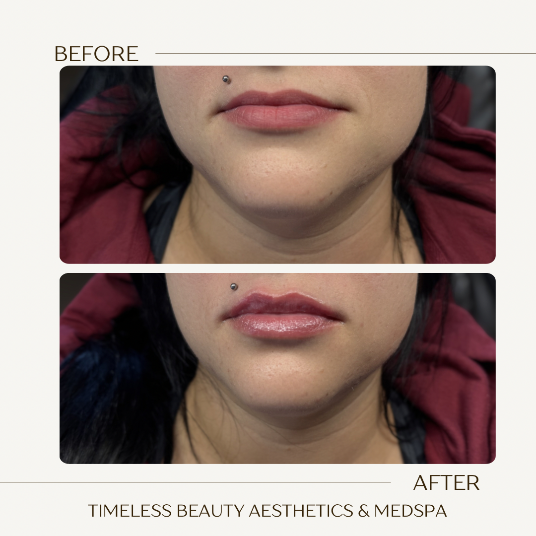 Beige Brown Neutral Before + After Instagram Post.png