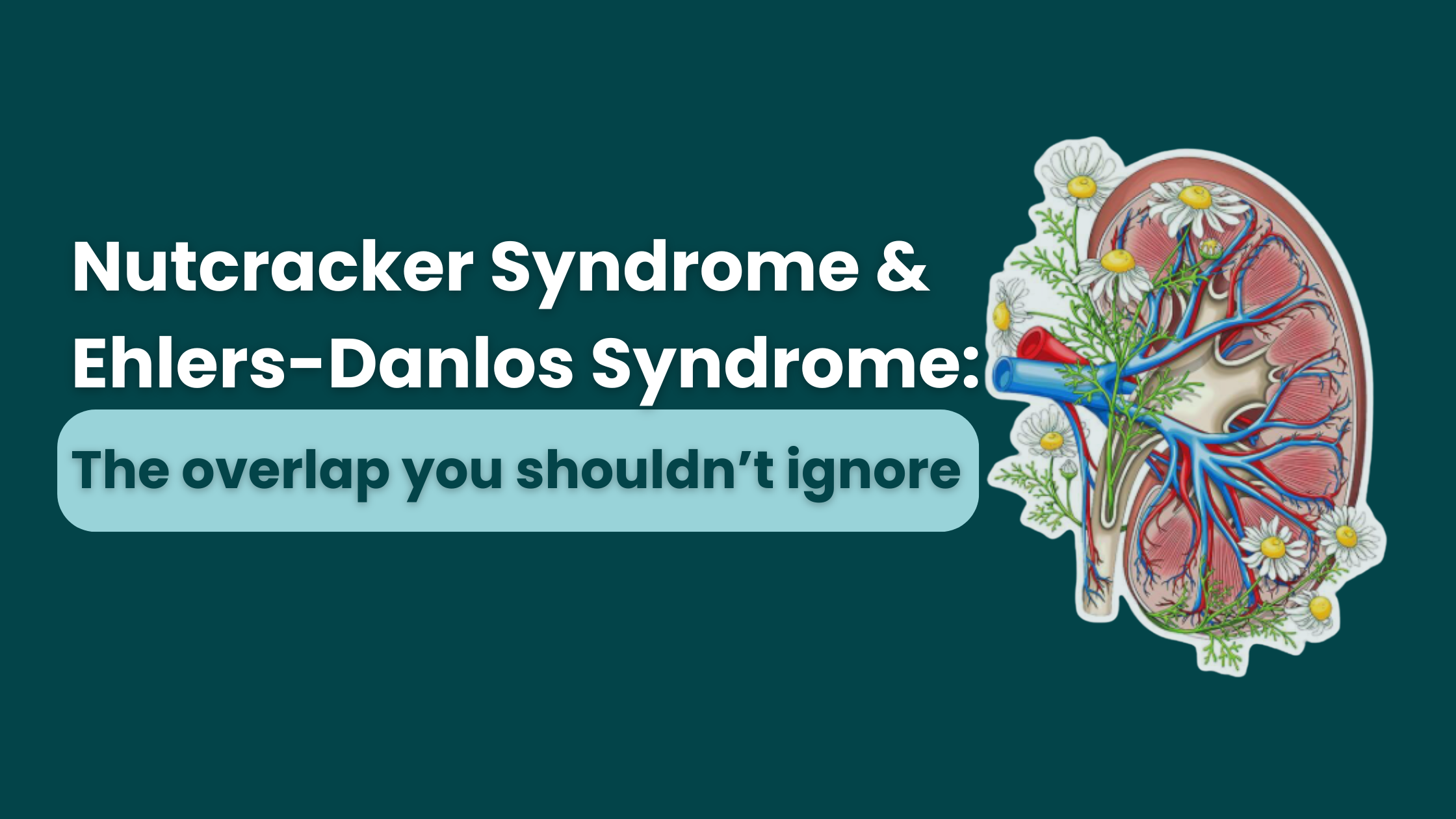 Nutcracker Syndrome and Ehlers-Danlos Syndrome: The Overlap You Shouldn’t Ignore