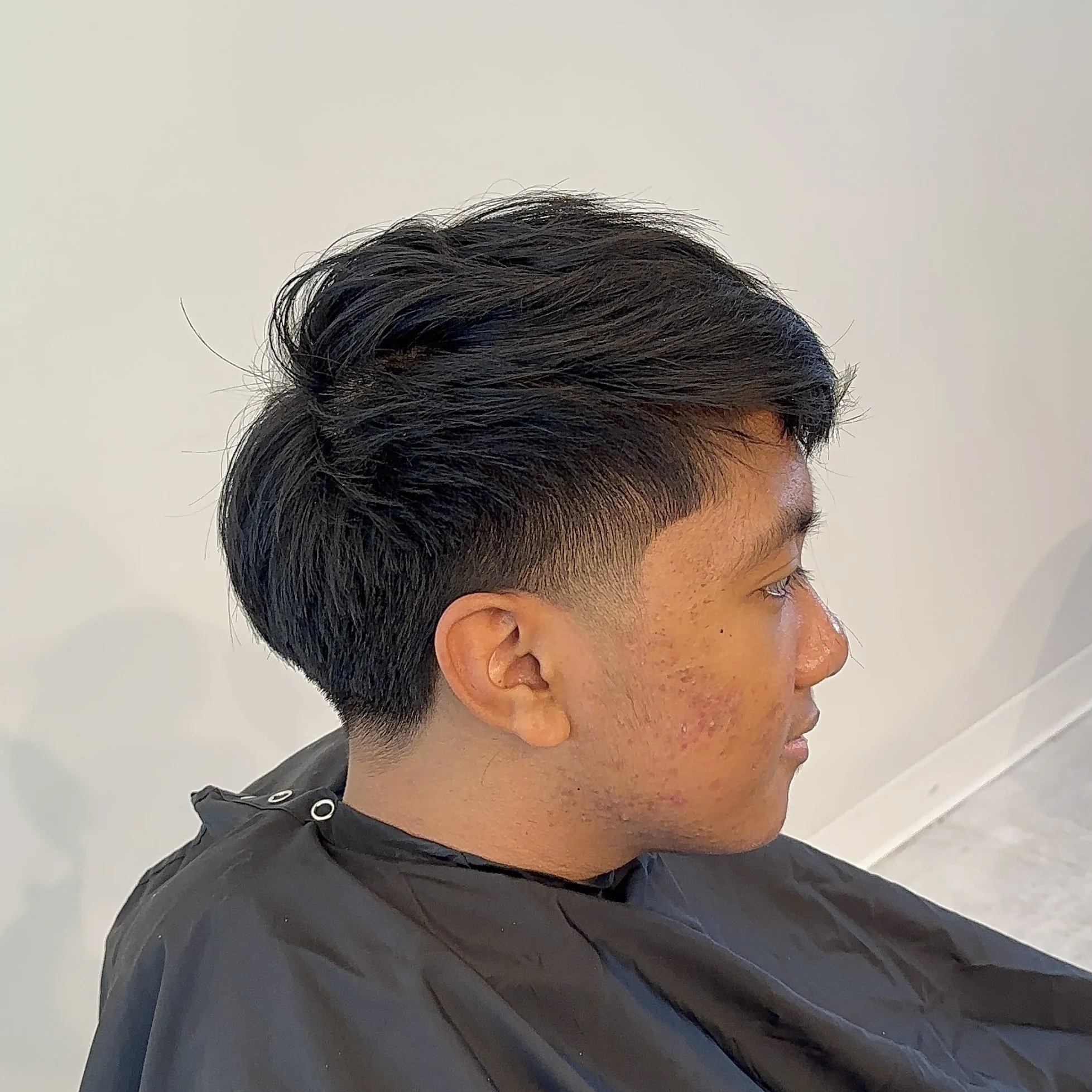 Profile of a young man with dark, styled hair, and acne-prone skin, seated in a salon or barbershop chair.