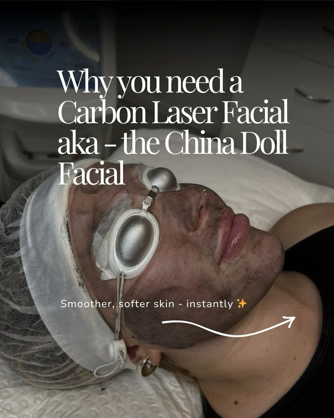 Why the China Doll Facial is your next lunch break appointment 👇🏼

1. It&rsquo;s a deep pore cleanse -  Say goodbye to blackheads, congestion and excess oil. Carbon penetrates deep into your pores and lifts out everything that shouldn&rsquo;t be th