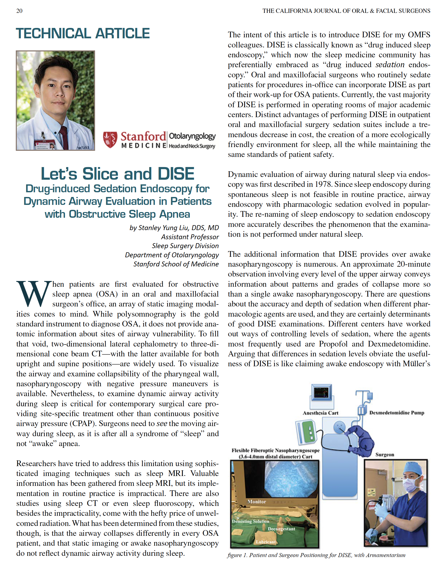 Technical Article on Drug-Induced Sleep Endoscopy (DISE)