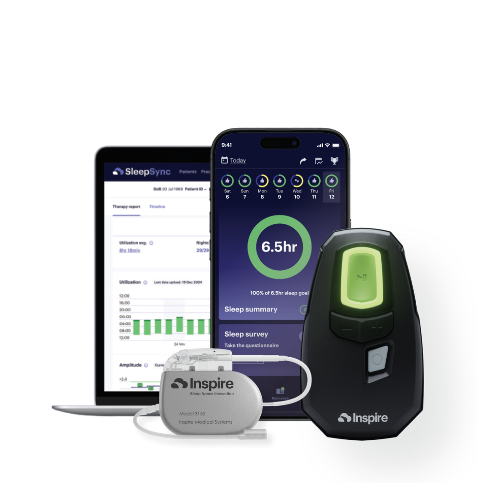 Inspire V hypoglossal nerve stimulation system for obstructive sleep apnea, with the patient remote and sleep app