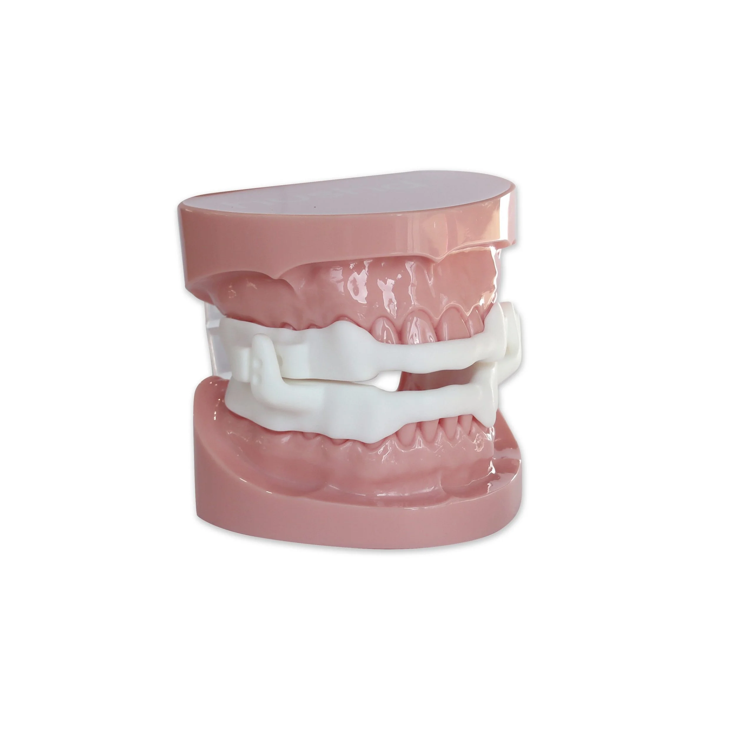 Dental model displaying upper and lower teeth with orthodontic retainers.